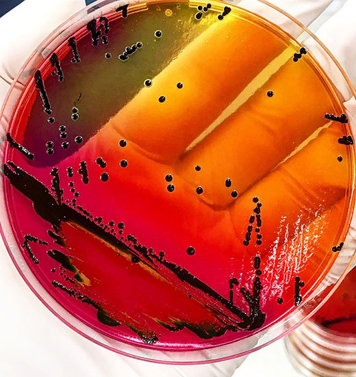 Petri dish showing salmonella collected from environmental samples in Cambodia
